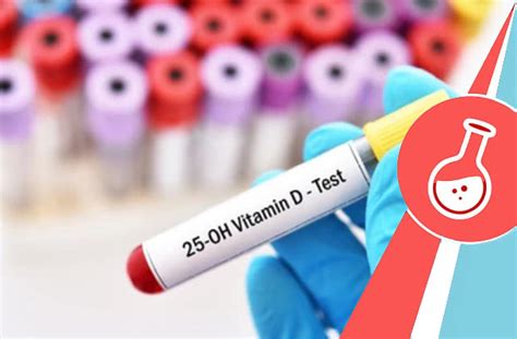 vit d blood test bottle colour|vitamin d 25 oh test.